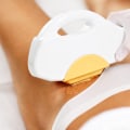 What to Do if You Experience Discomfort After Laser Hair Removal