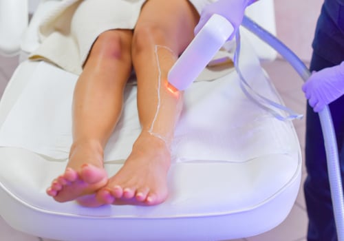Is Laser Hair Removal Working? Here's How to Know for Sure