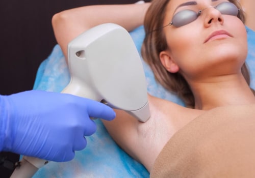 Can Laser Hair Removal Cause Fever? - An Expert's Perspective